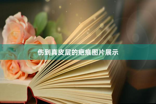 伤到真皮层的疤痕图片展示